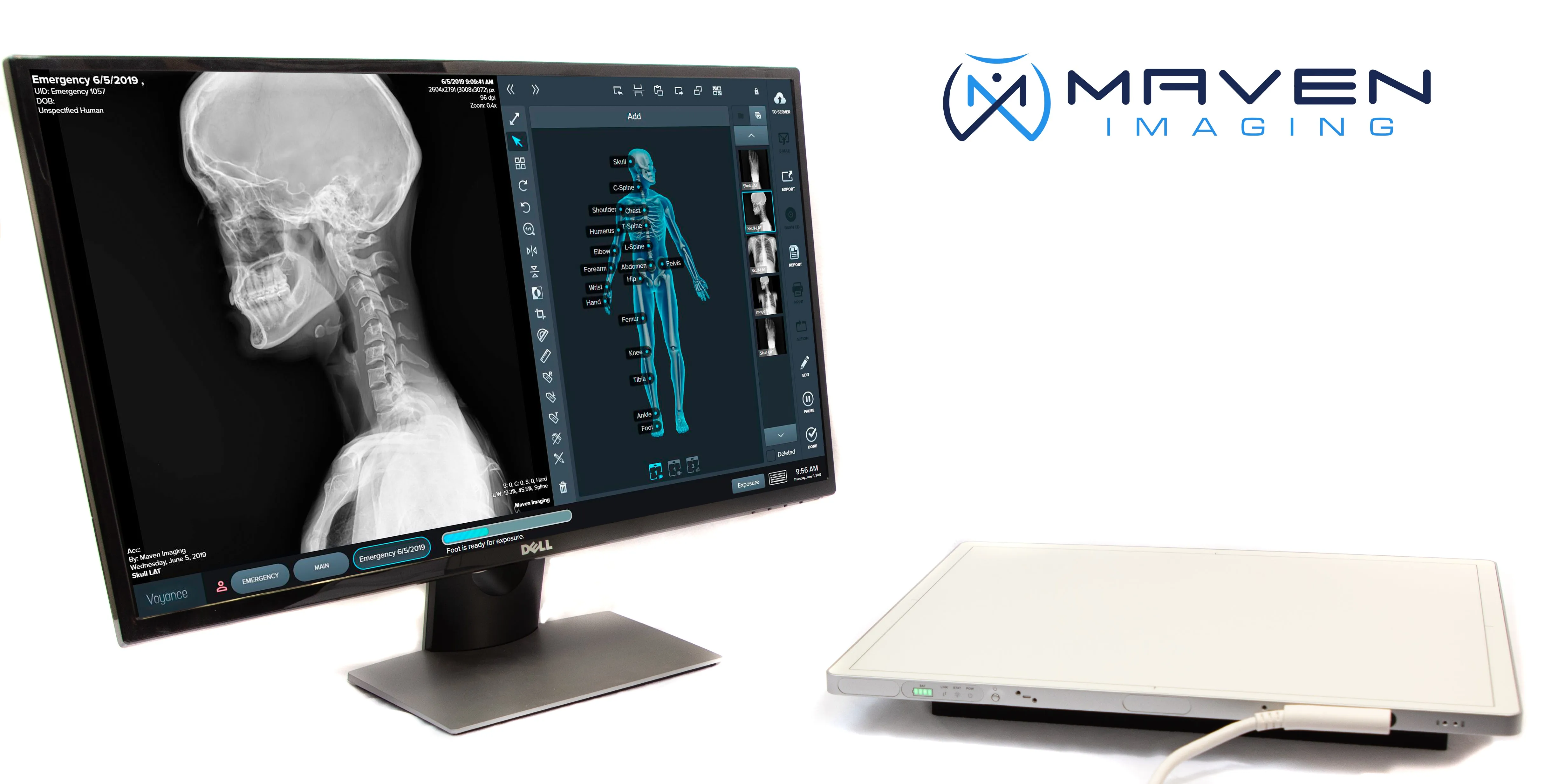 Maven Digital Straight Arm with CPI Generator