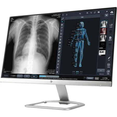 TXR GP-6 System, Urgent Care and wireless DR package